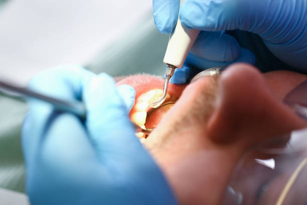 Best Same-Day Emergency Dentist in Shil, OH