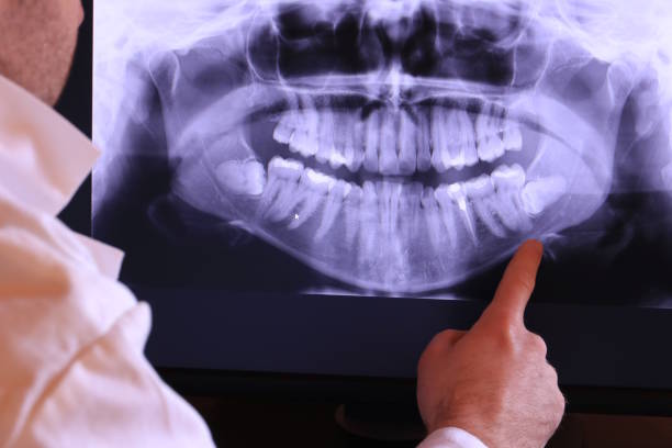 Best Emergency Tooth Extraction in Shil, OH